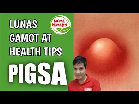 paano kainin ang puke|Gamot sa Pigsa at Home Remedies para Dito .